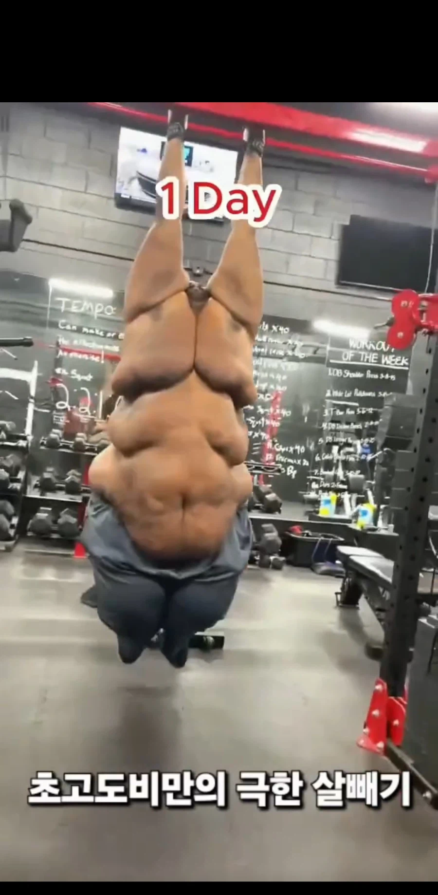 초고도 비만의 다이어트 시작과 1년 후_1.webp