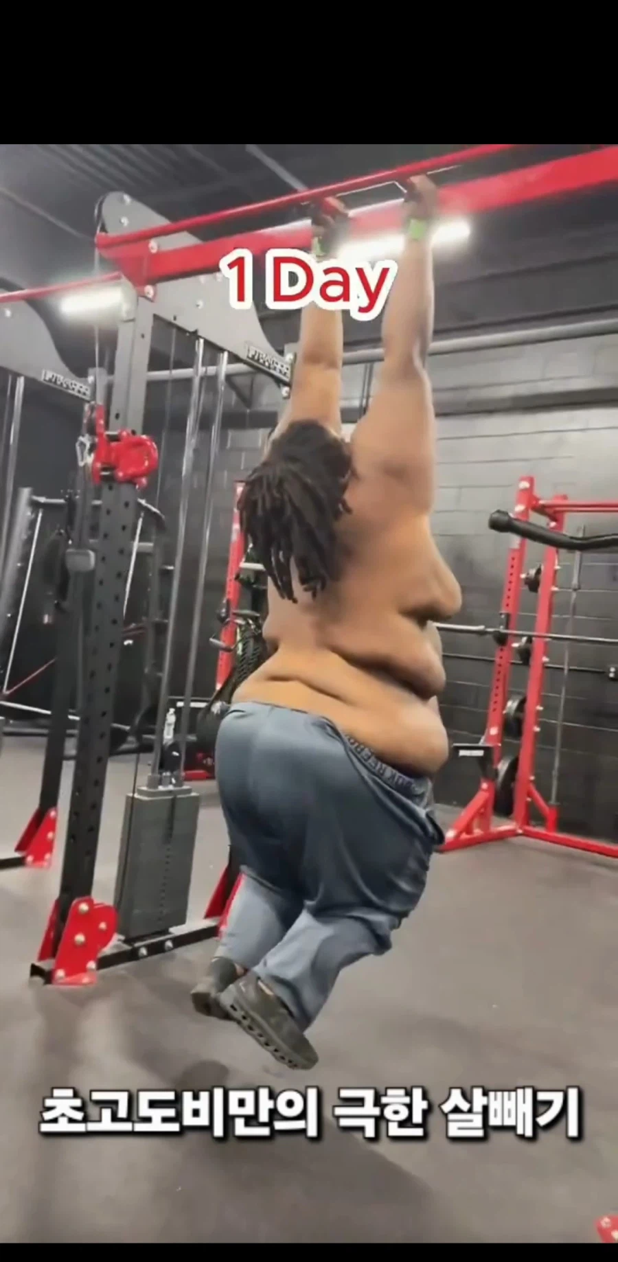 초고도 비만의 다이어트 시작과 1년 후_2.webp