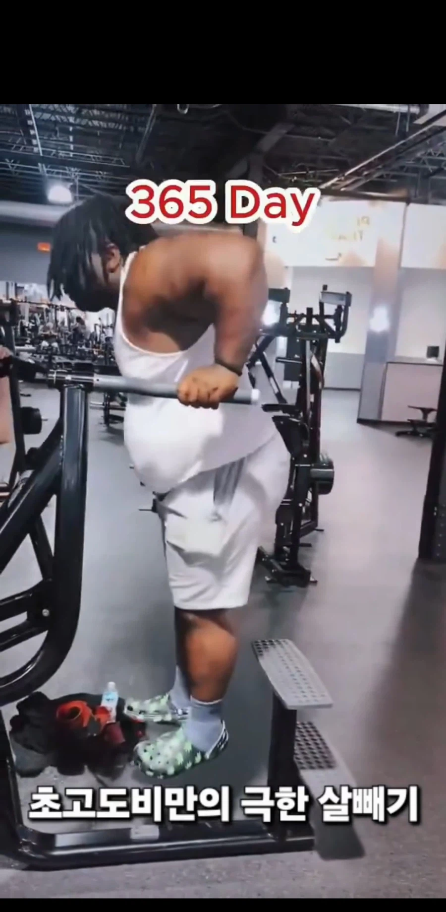 초고도 비만의 다이어트 시작과 1년 후_3.webp