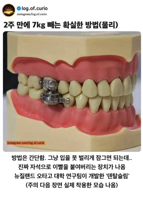 약 운동 없이 2주만에 7키로 감량 비법(물리)._1.webp