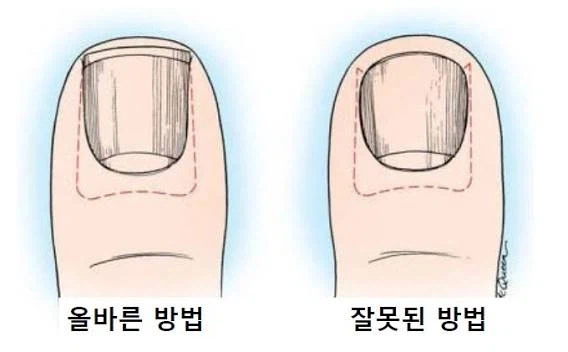 인체의 흔한 함정카드.jpg_2.webp