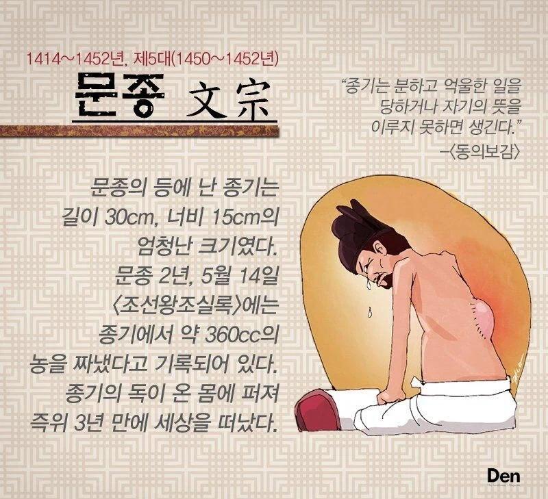의외로 진지하게 가족력 의심되는 조선왕실의 등창 수난사_1.webp