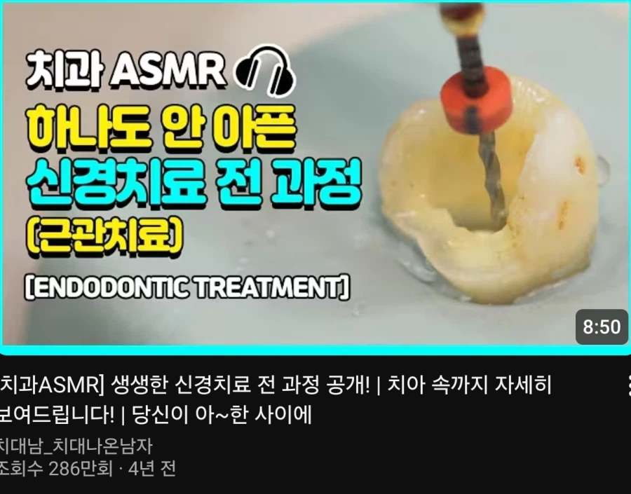 하나도 안아픈 신경치료_1.webp