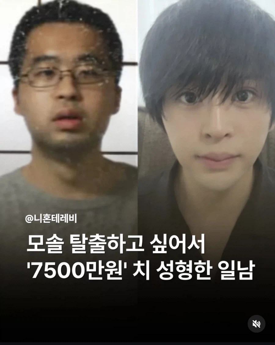 모솔 탈출하려고 7500만원어치 성형한 남자_1.webp