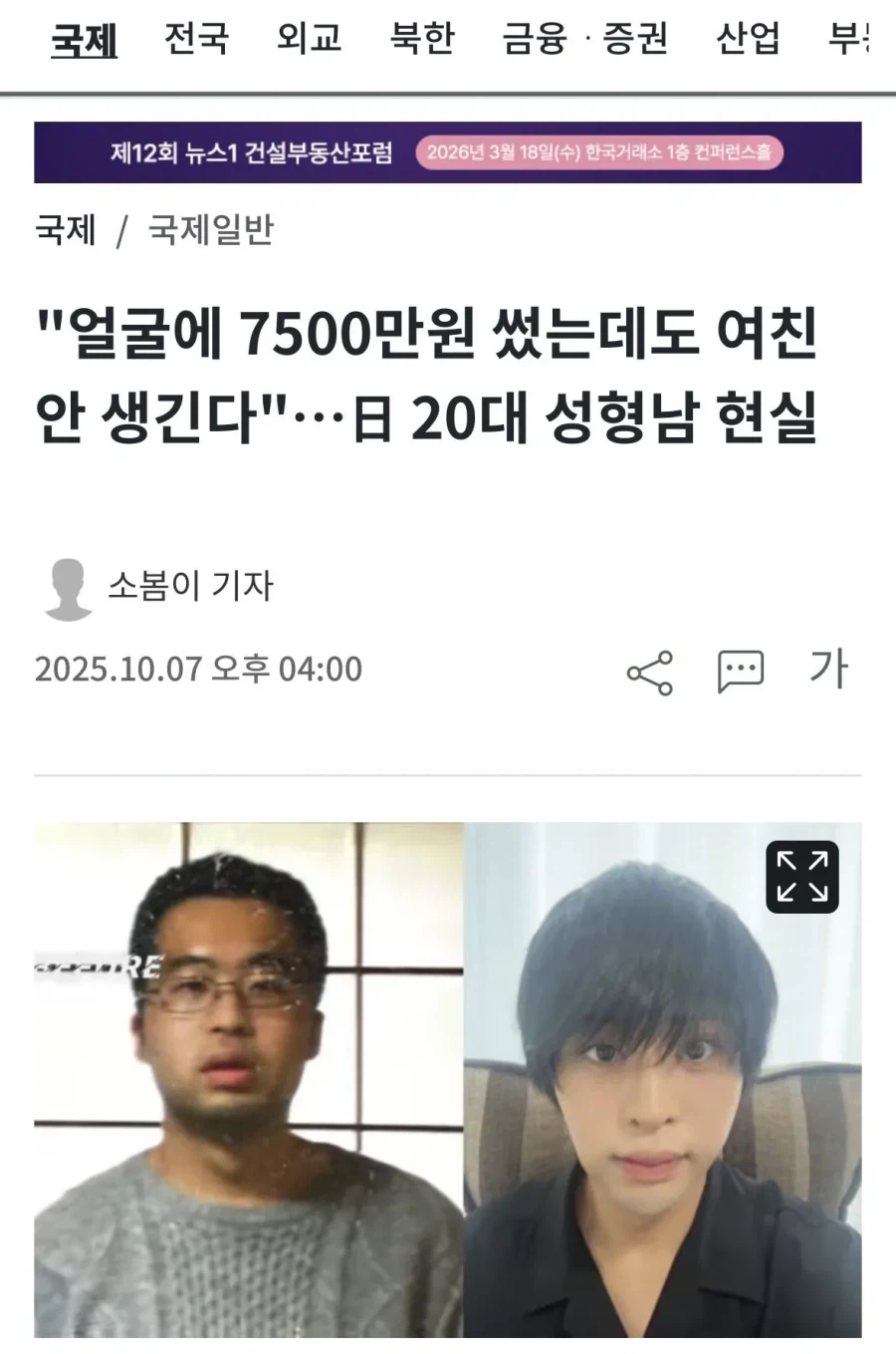모솔탈출하려고 7500만원주고 성형했다는 일본 남자...jpg_1.webp