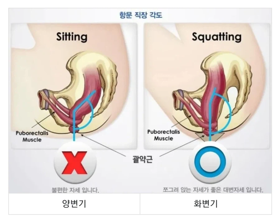 큰거보기 최적화 된 변기_2.webp