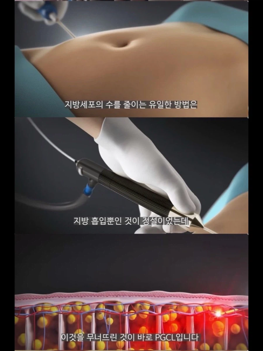 서양 보디빌더들이 가축용 약물까지 손대는 이유.jpg_5.webp