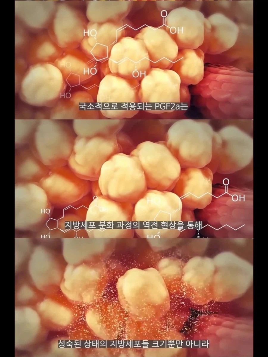 서양 보디빌더들이 가축용 약물까지 손대는 이유.jpg_6.webp