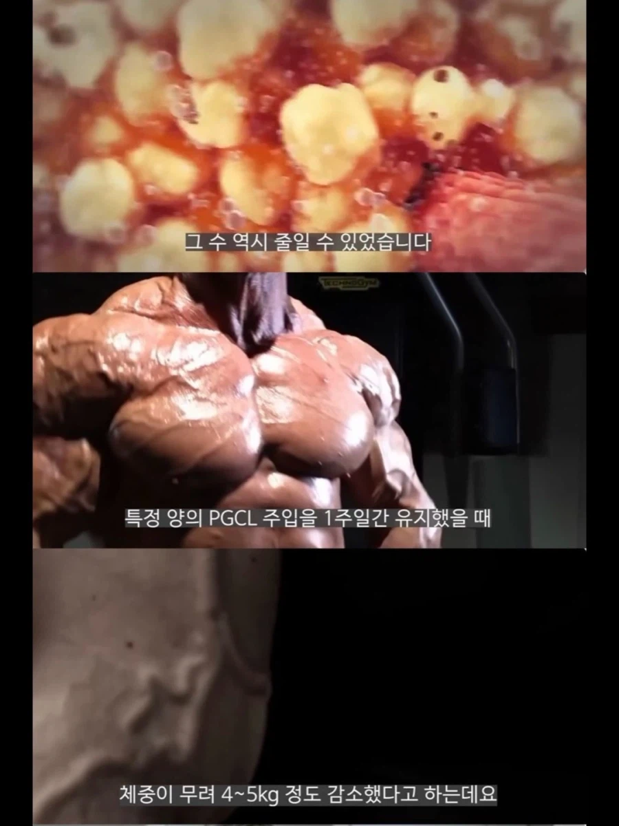 서양 보디빌더들이 가축용 약물까지 손대는 이유.jpg_7.webp