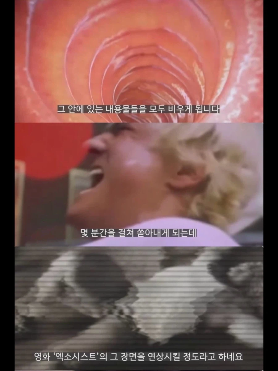 서양 보디빌더들이 가축용 약물까지 손대는 이유.jpg_11.webp