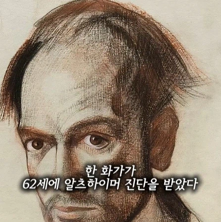 알츠하이머 환자가 자아를 잃어가는 과정.jpg_1.webp