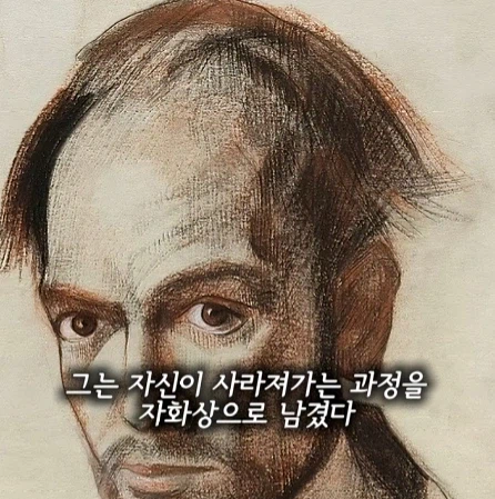 알츠하이머 환자가 자아를 잃어가는 과정.jpg_2.webp