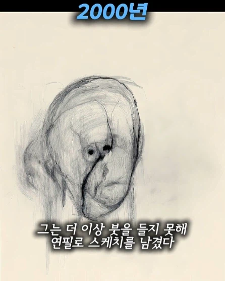 알츠하이머 환자가 자아를 잃어가는 과정.jpg_12.webp