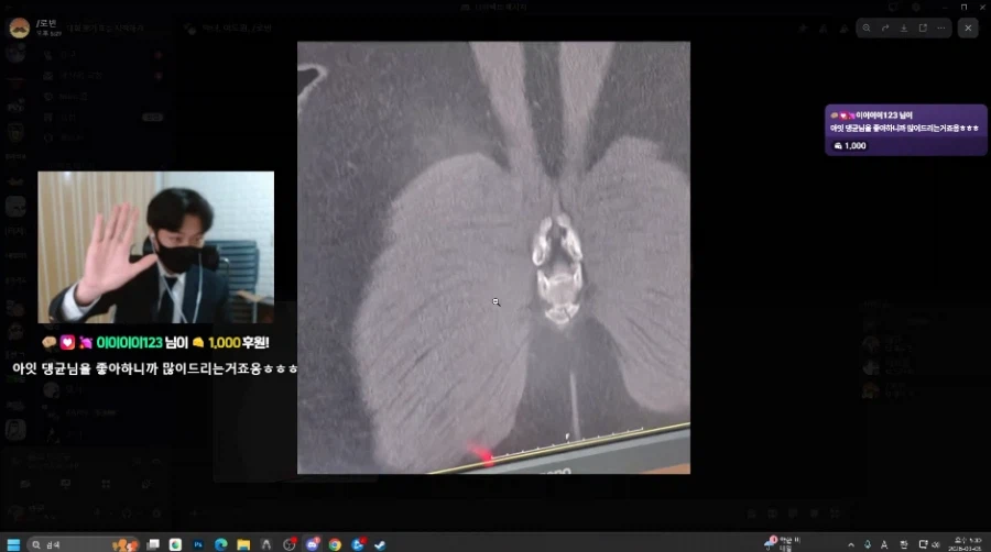 몬가가 몬가인 평범한 꼬리뼈 사진_8.webp