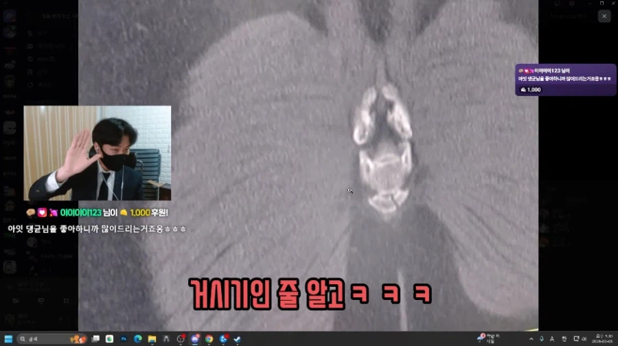 몬가가 몬가인 평범한 꼬리뼈 사진_9.webp