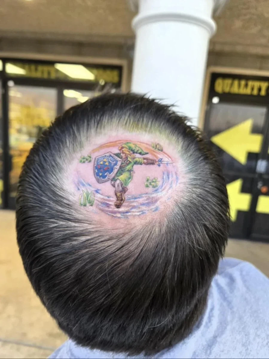 원형탈모를 유머로 극복한 아저씨_1.webp