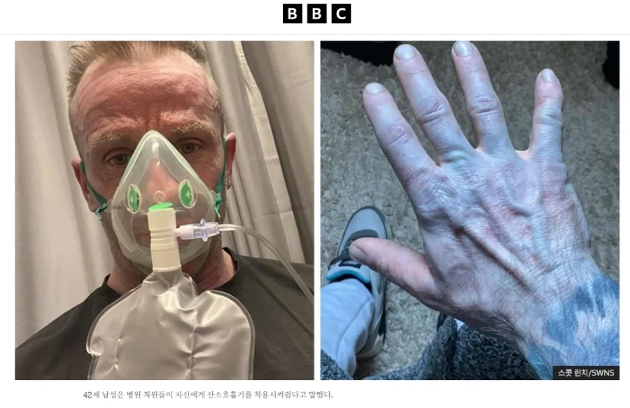 피부가 파래져서 응급실에 실려간 영국인_1.webp