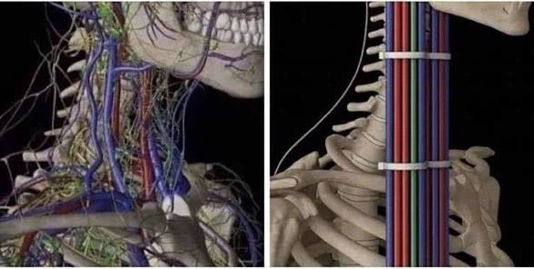 어지럽게 있던 선들 정리하기_1.webp