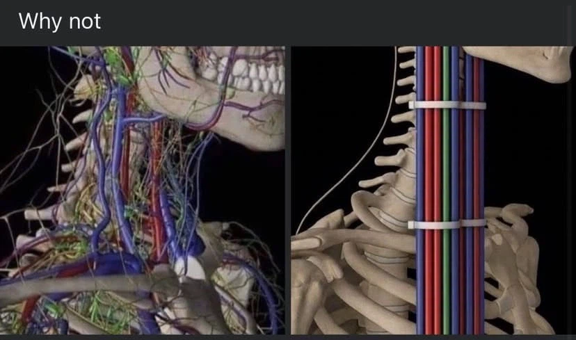 인간신체를 올바르게 하는 방법_1.webp