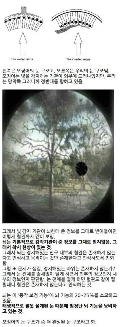 인체 사양 너무 구려요 새거 주세요_1.webp