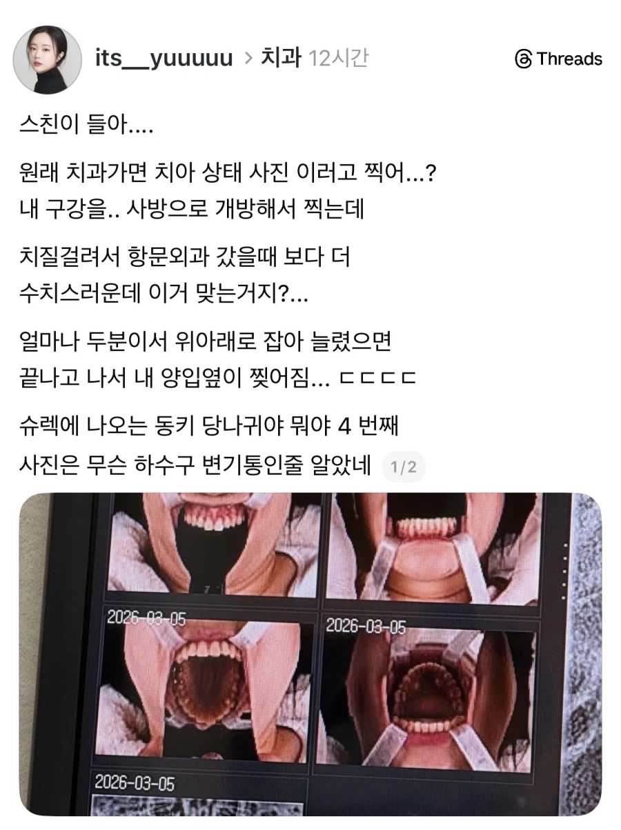 치과가면 사진 원래 이렇게 찍냐.jpg_1.webp