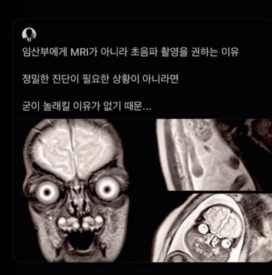 약혐)태아 MRI 사진 찍으면 벌어지는 일_1.webp