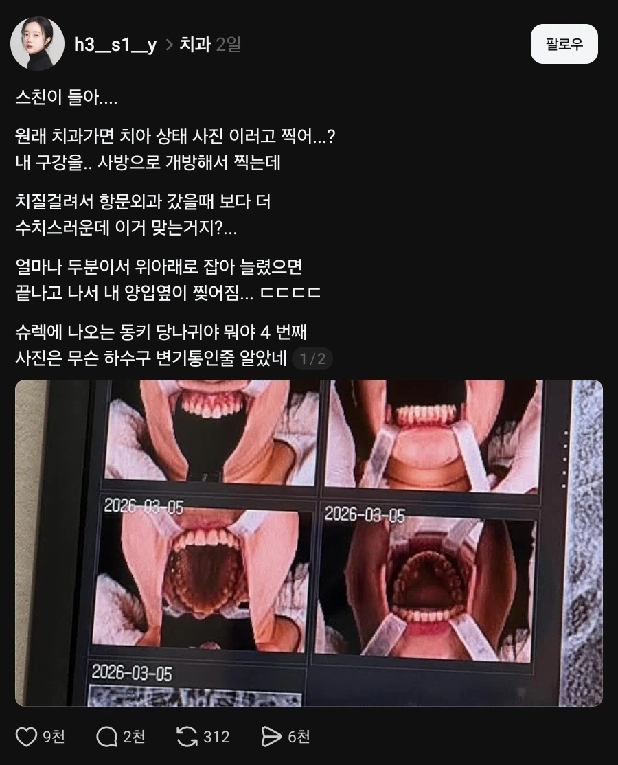 치과 굴욕샷_1.webp
