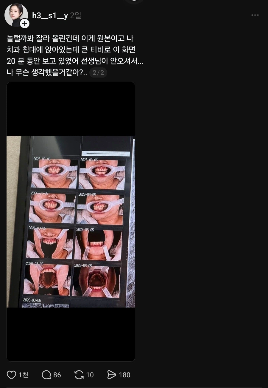 치과 굴욕샷_2.webp