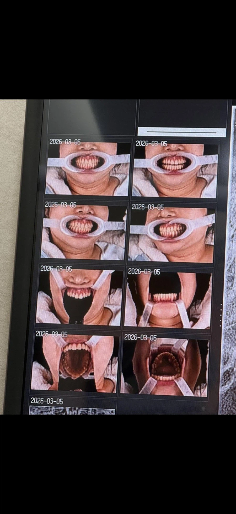 치과 굴욕샷_3.webp