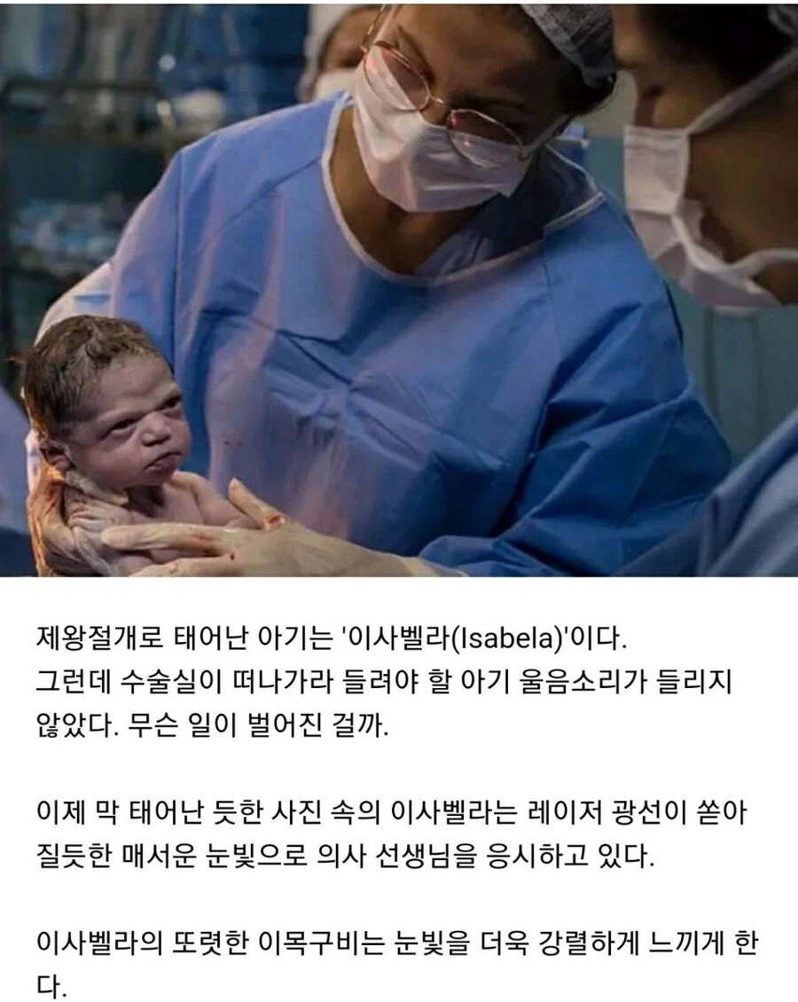 태어나자마자 의사선생님 노려본 아기.jpg_1.webp