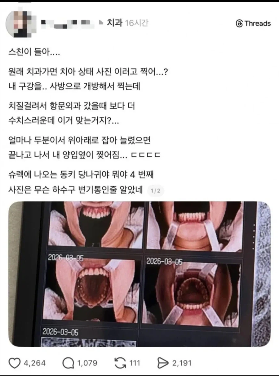 입 능지처참하는 치과_1.webp