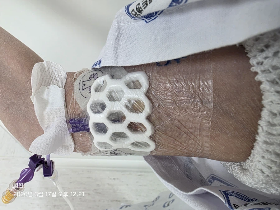 잡으면 뚝 부러질 나의 팔을 보라_4.webp