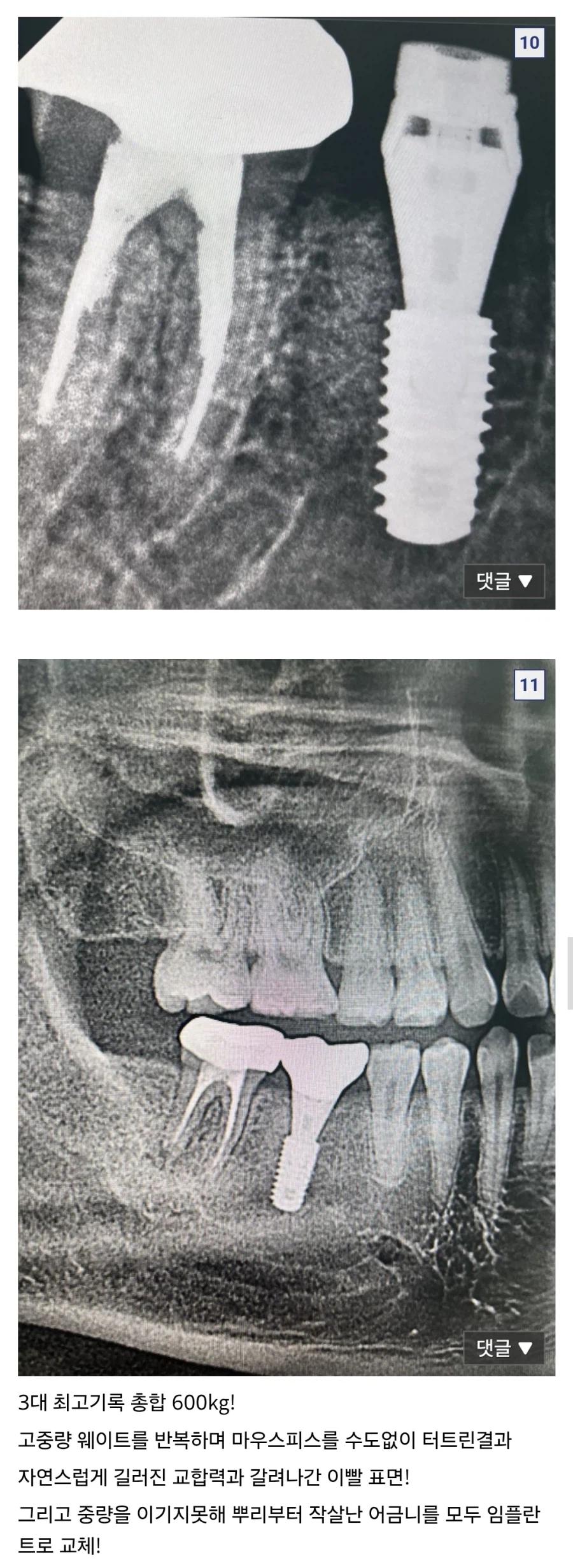 바키)바붕아... 너는 너 무 강 해 졌 다_3.webp