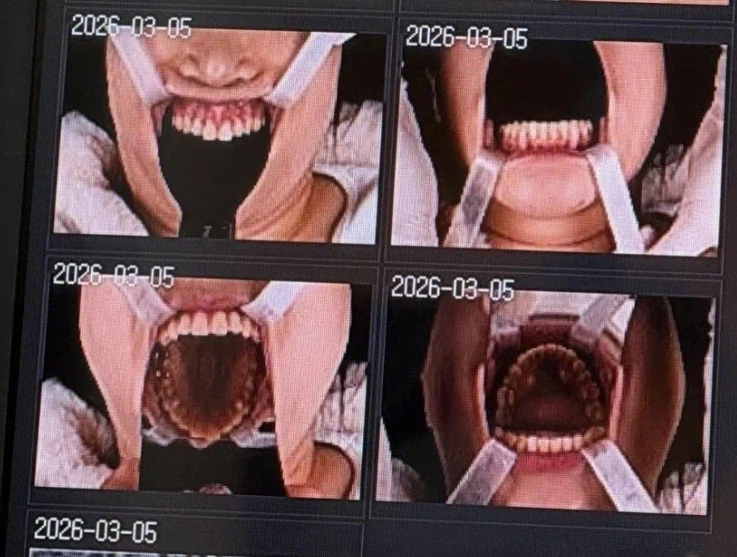 치과에서 수치 당한 사람_3.webp