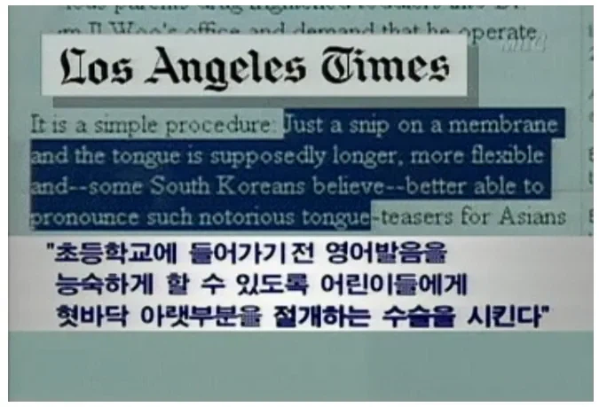 20-30년전 강남에서 유행했던 수술_2.webp