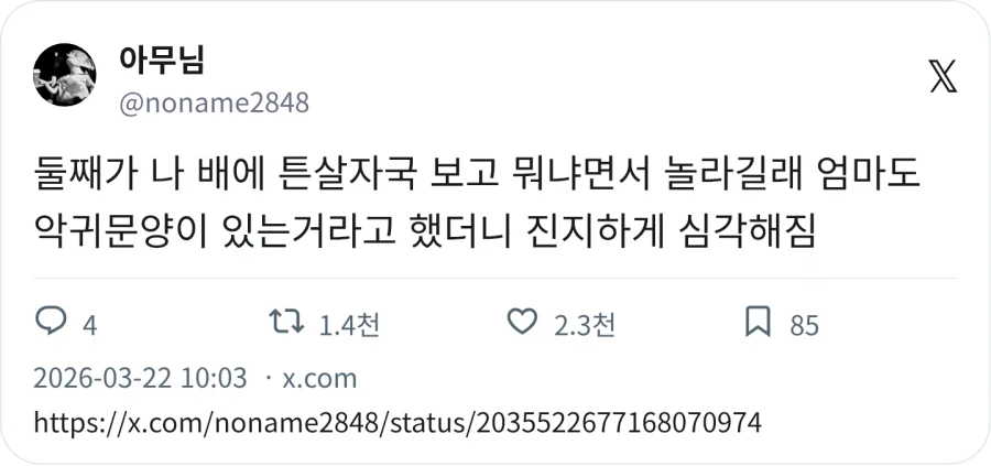 둘째 : 엄마 배에 자국 뭐야 ?_1.webp