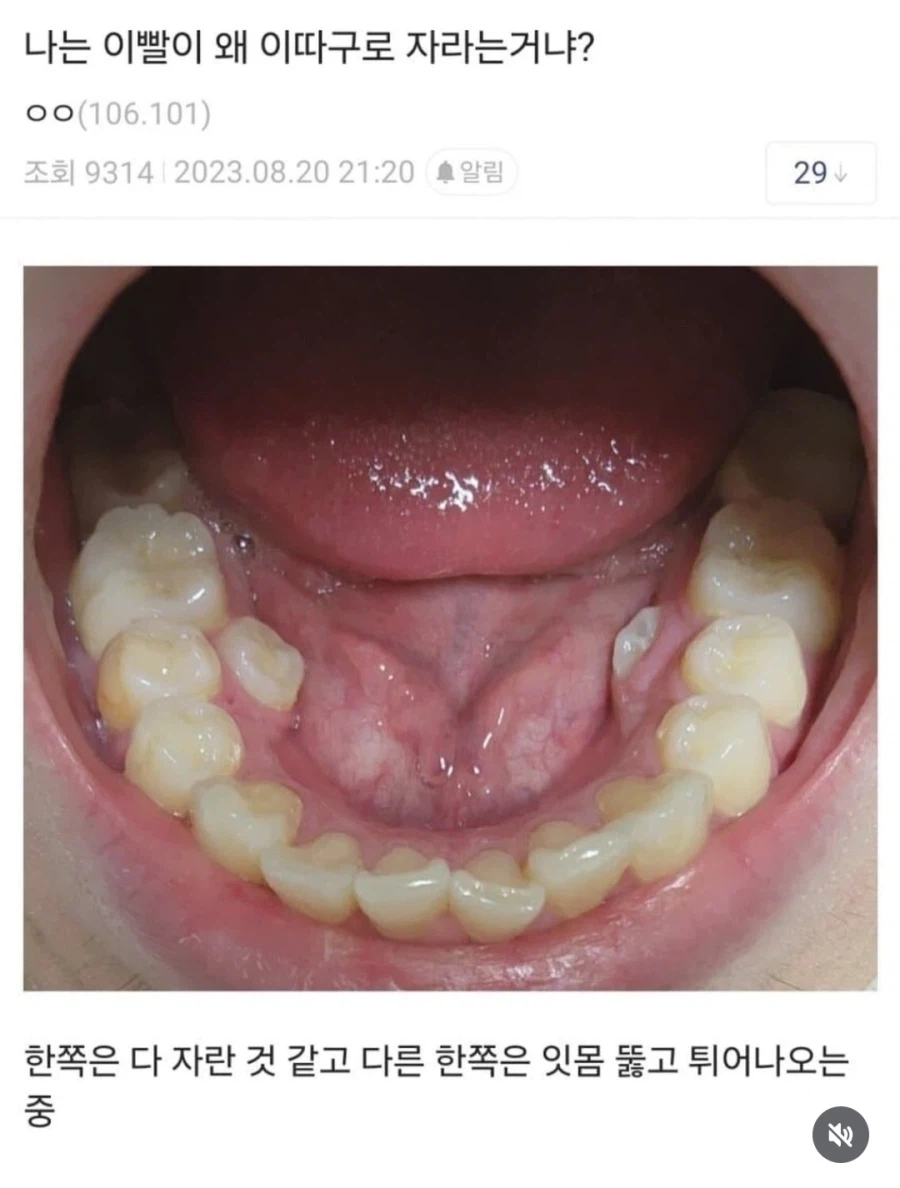 이빨이 기묘하게 자란 dc인_1.webp