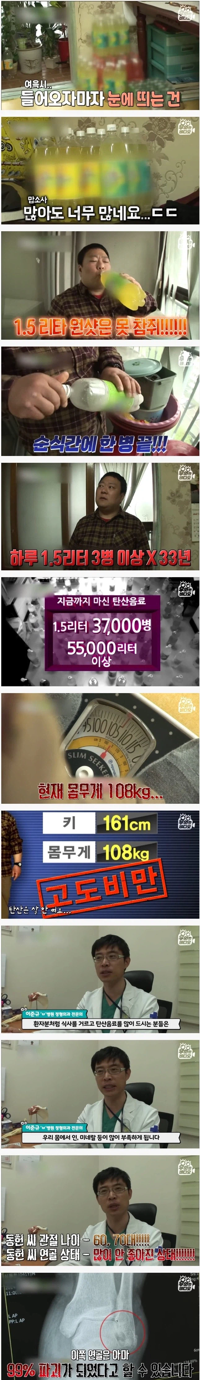 1.5리터짜리 탄산음료 하루 3병 마시는 사람의 몸 상태_1.webp