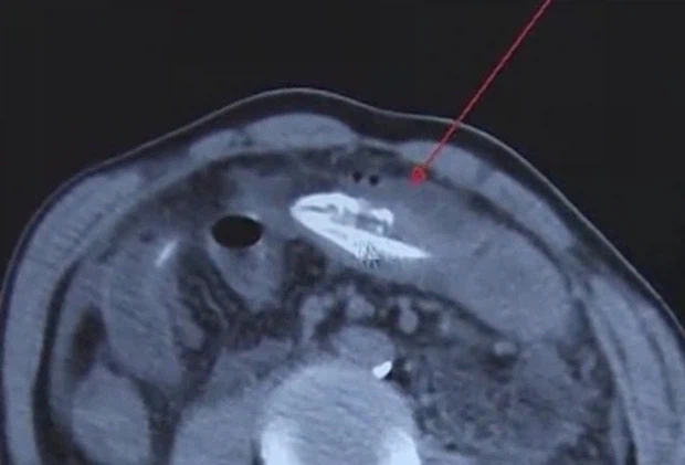 (약혐) 장어와 합체하는 사람들.jpg_3.webp