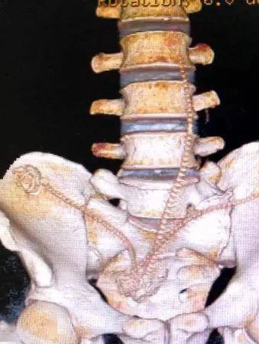 (약혐) 장어와 합체하는 사람들.jpg_6.webp