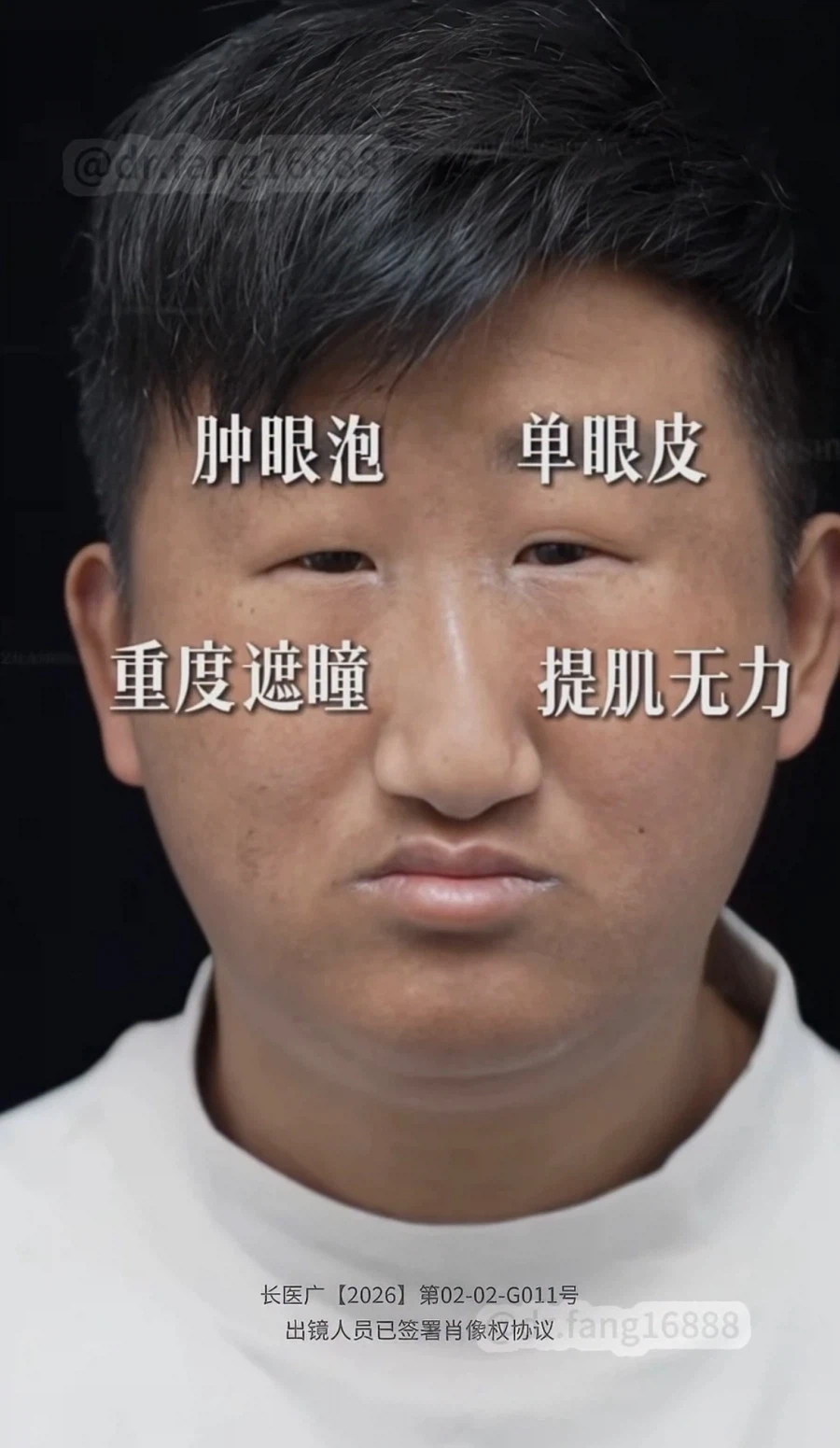 ???: 어머 고객님 수술 너므 잘되셨다 ㅎㅎ_1.webp