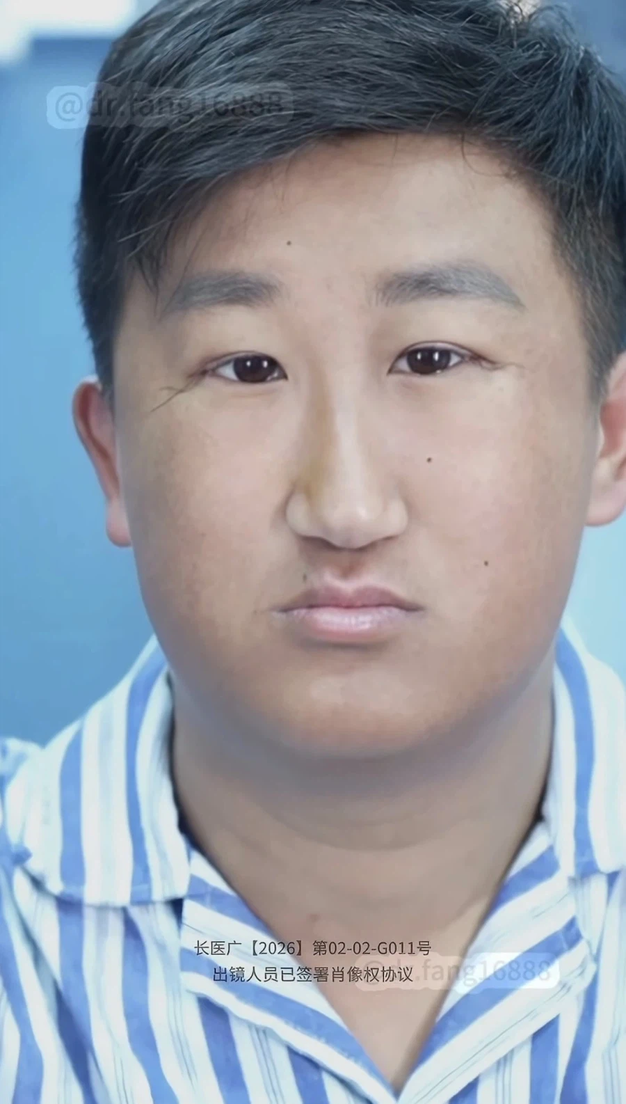 ???: 어머 고객님 수술 너므 잘되셨다 ㅎㅎ_4.webp