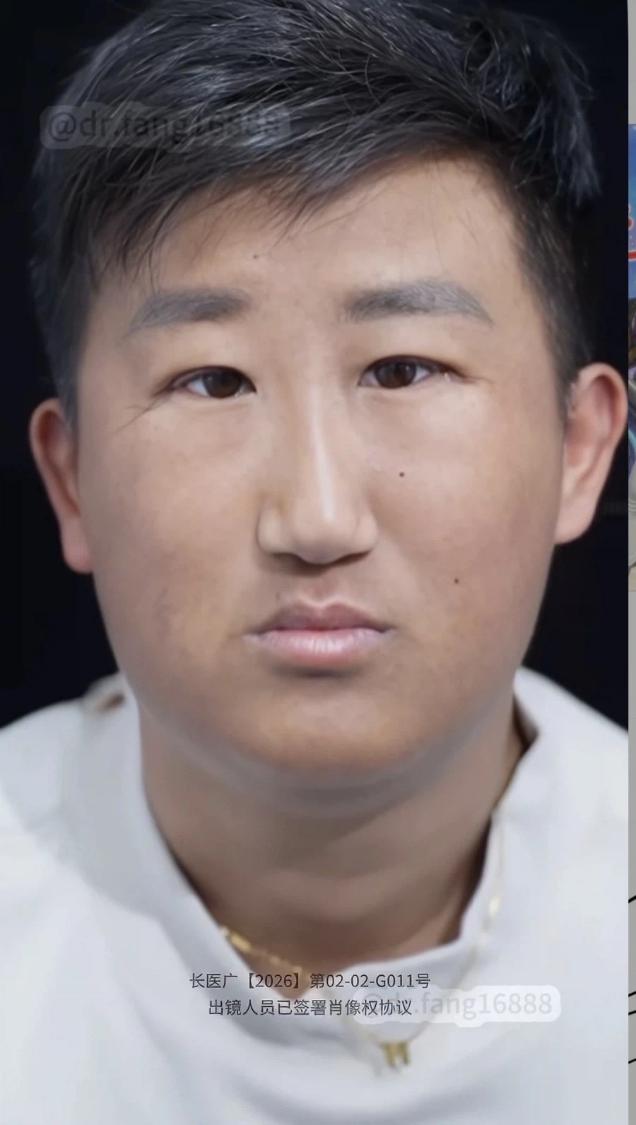 ???: 어머 고객님 수술 너므 잘되셨다 ㅎㅎ_5.webp