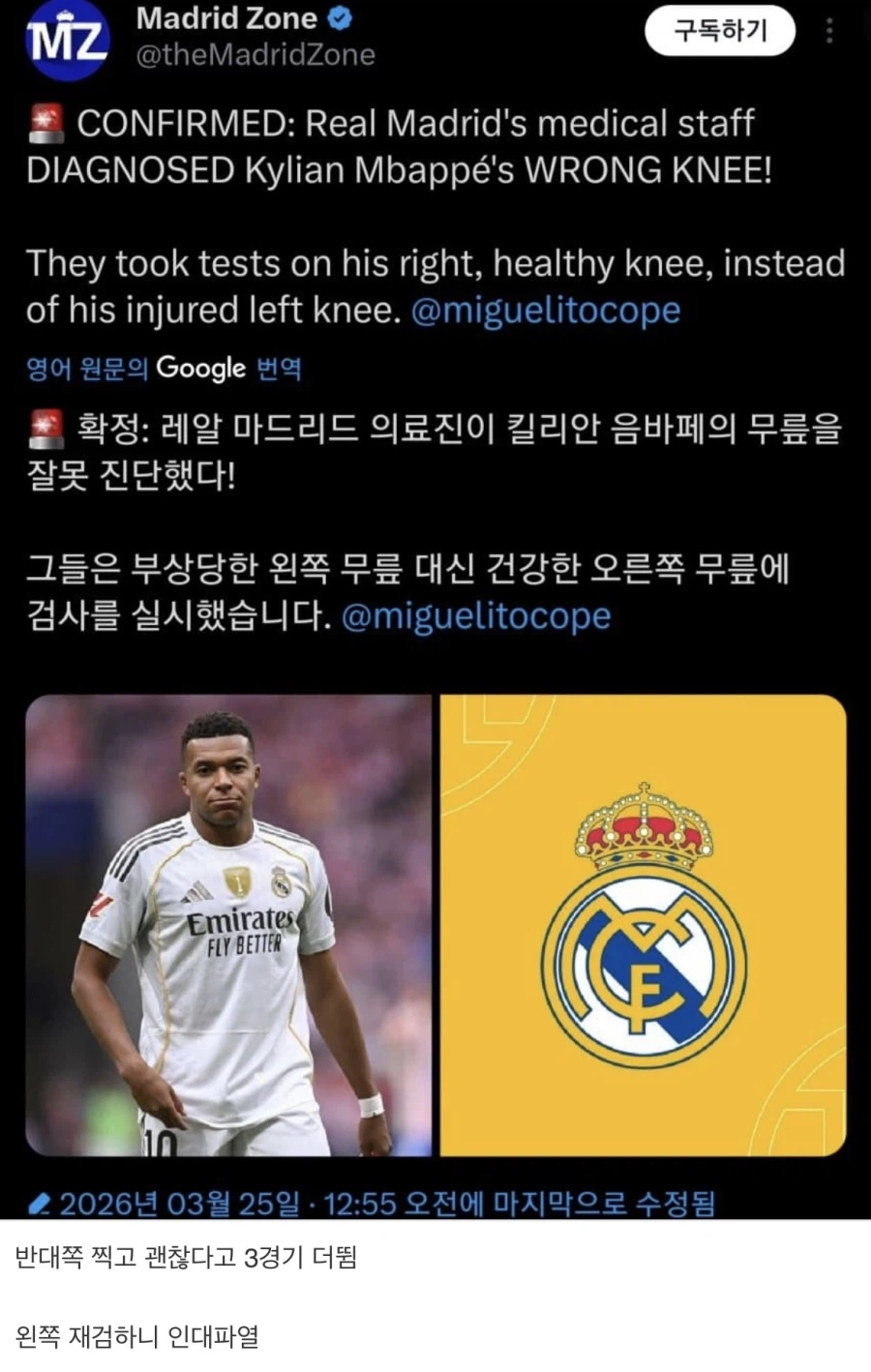 음바페 인대파열.news_1.webp