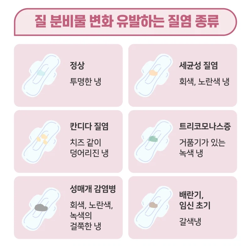 색으로 보는 보지상태_1.webp