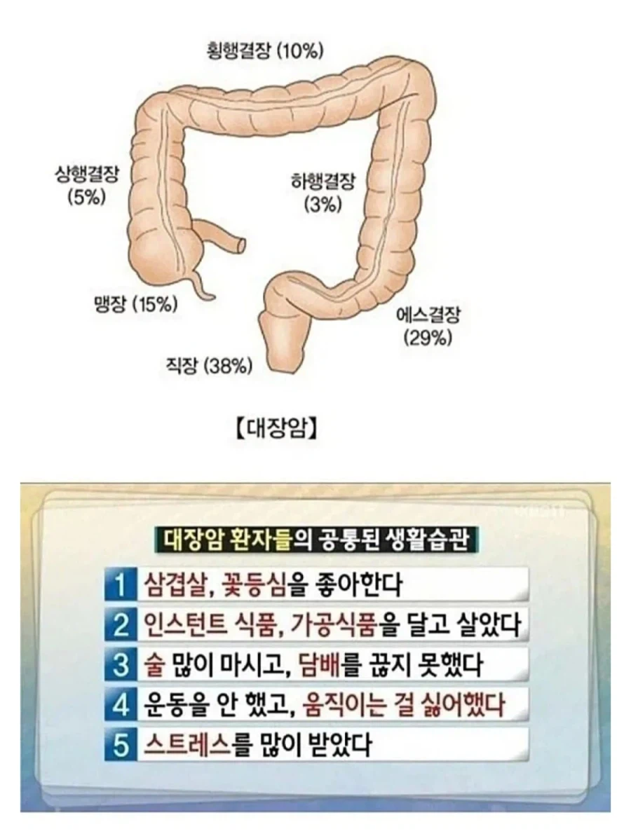 대장암 환자들의 공통된 생활습관.jpg_1.webp