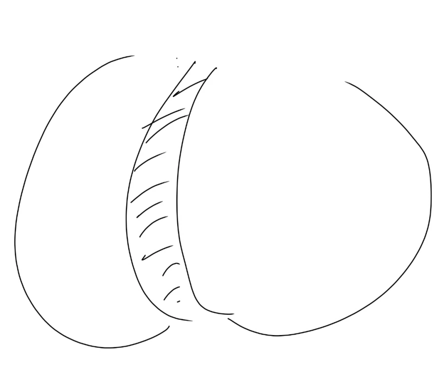 찌플레이션으로 일어나고있는 부작용_1.webp