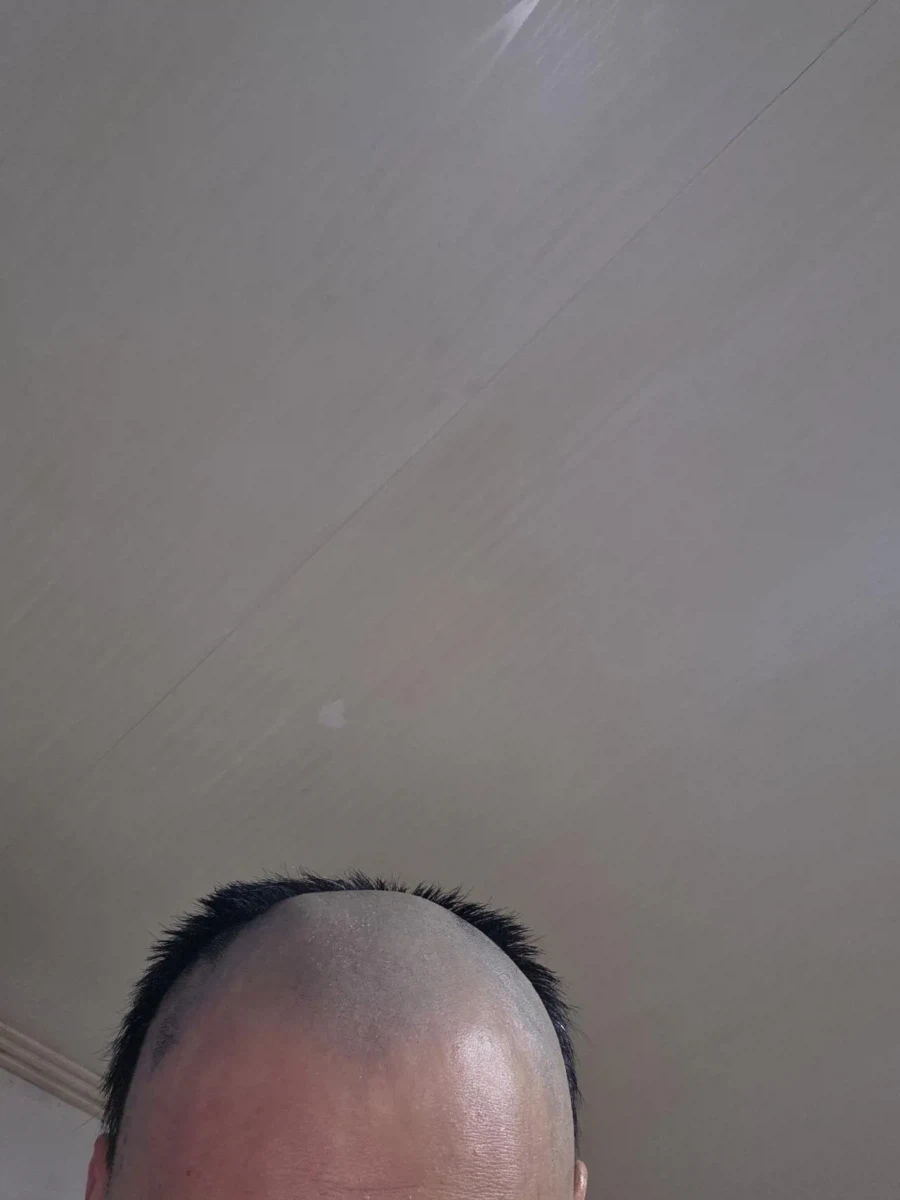 머리 망했다..._2.webp