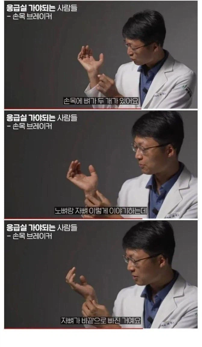 손목 탈구된 디씨인 본 응급의학과 교수_4.webp