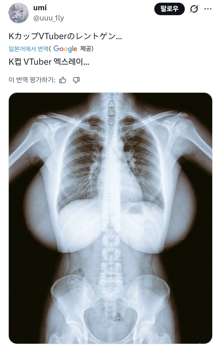 의외로 남자들이 무서워하는 엑스레이 사진.jpg_1.webp